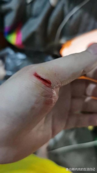 手