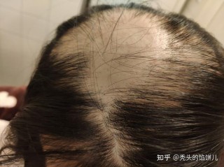 秃头饭后走 （打一字）