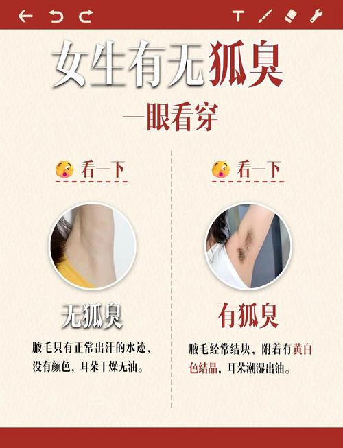 三个小妙招轻松解决狐臭问题 第1张 三个小妙招轻松解决狐臭问题 第1张