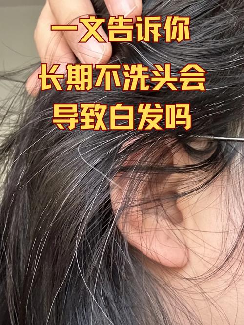 头上找白发 （打四字国名）  第1张