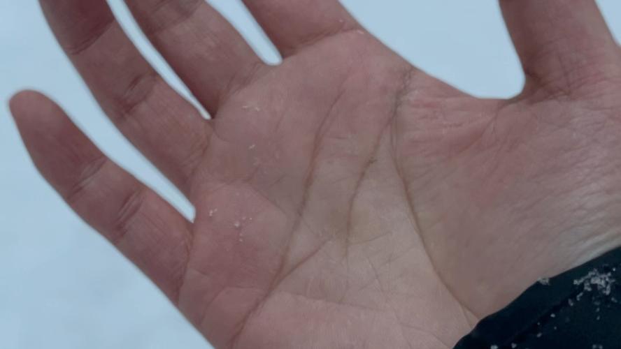 掌心化雪 第1张 掌心化雪 第1张