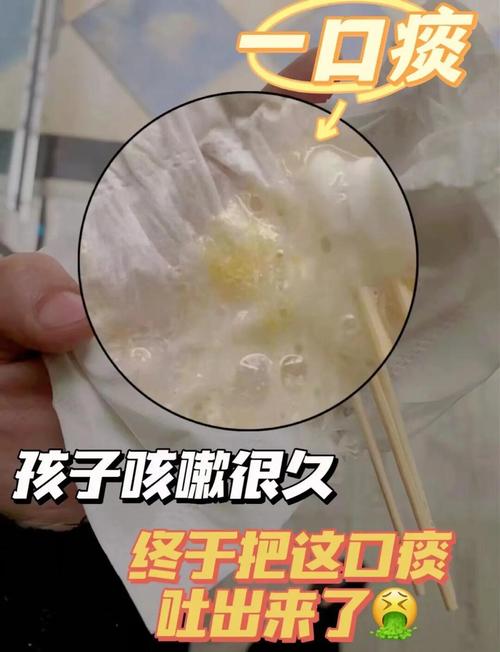 圾灸吵酱虫闹痰拆嘀 第1张 圾灸吵酱虫闹痰拆嘀 第1张